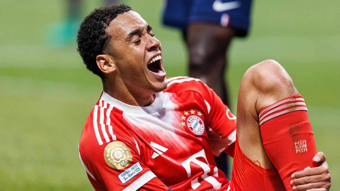 Jamal Musiala hält sich im Klub-WM-Spiel gegen Paris Saint-Germain das gebrochene Wadenbein