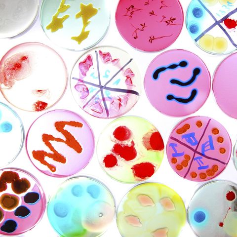 Bacteria in petri dishes as culture