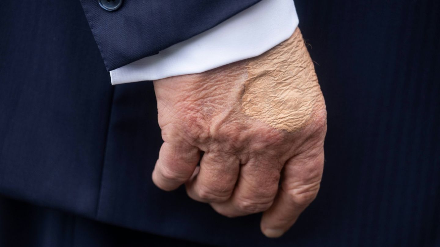 Hand von US-Präsident Trump