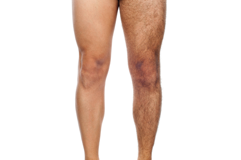 Beine glatt oder behaart? Das hängt auch vom Land ab, aus dem der Mann kommt