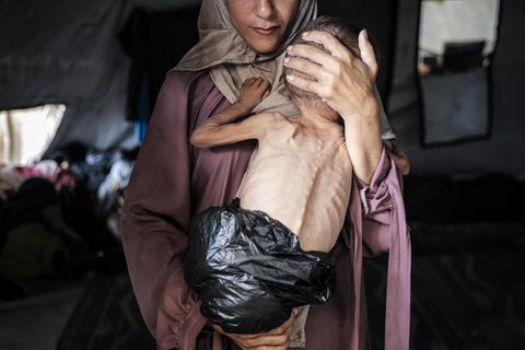 Mutter mit unterernährtem Kind in Gaza
