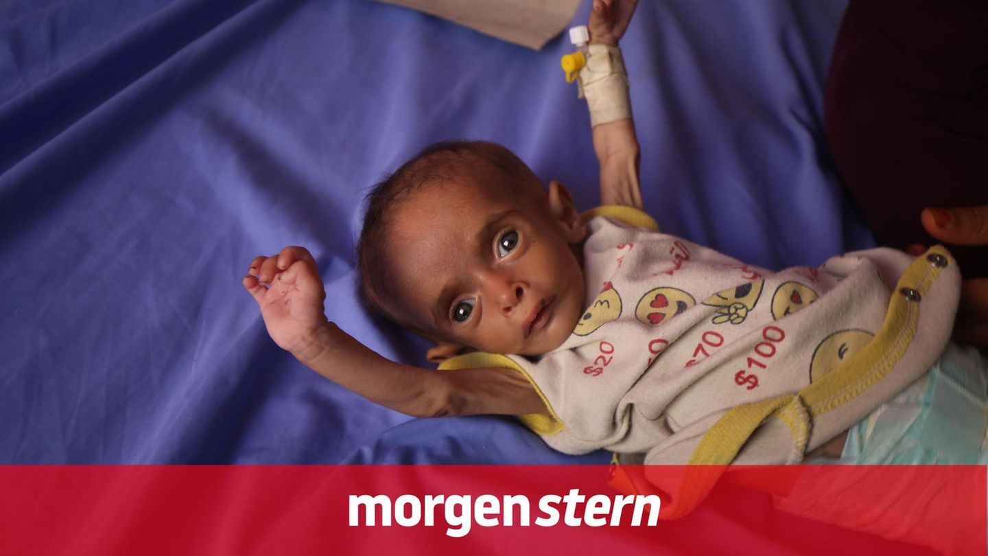 Gaza hunger. And it doesn’t get any better. The situation in the morning