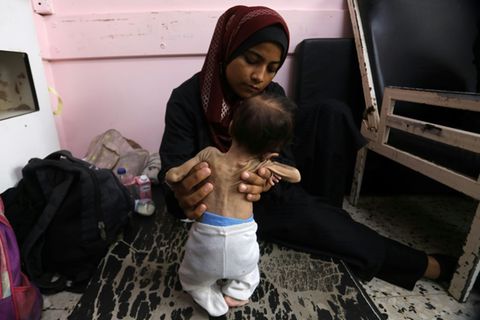 Eine Mutter in Chan Junis hält ihr unterernährtes Baby