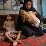 Fotos aus dem abgeriegelten Gebiet, in dem Israel Krieg gegen die islamistische Hamas führt, zeigen abgemagerte Kleinkinder in den Krankenhäusern. Auch diese Jungen in einer Unterkunft im Nordwesten von Gaza-Stadt leiden neben zerebraler Lähmung auch an Unterernährung