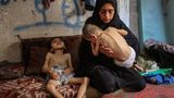 Fotos aus dem abgeriegelten Gebiet, in dem Israel Krieg gegen die islamistische Hamas führt, zeigen abgemagerte Kleinkinder in den Krankenhäusern. Auch diese Jungen in einer Unterkunft im Nordwesten von Gaza-Stadt leiden neben zerebraler Lähmung auch an Unterernährung
