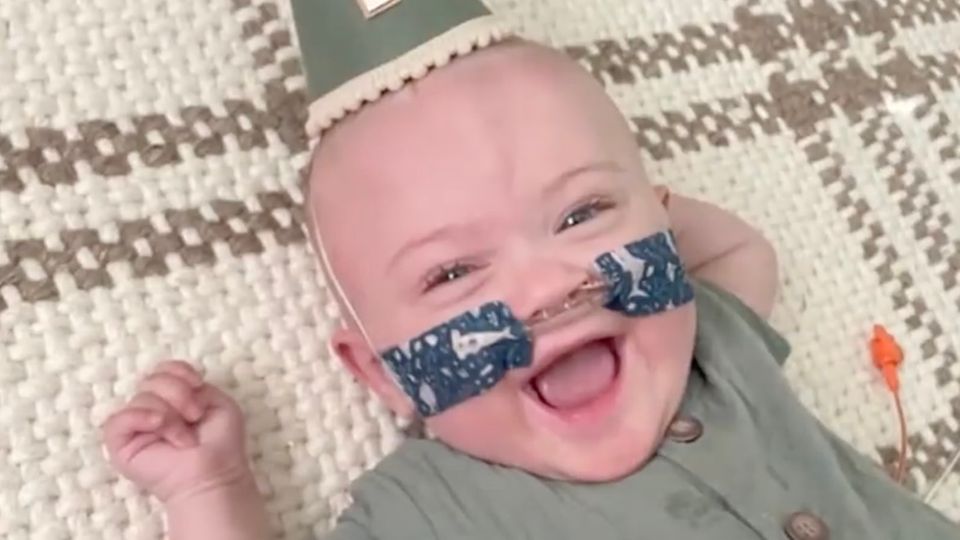 Weltrekord Frühchen Nash Nash trägt einen Partyhut und lacht fröhlich in die Kamera. Dazu trägt er eine Sauerstoff-Nasenbrille.