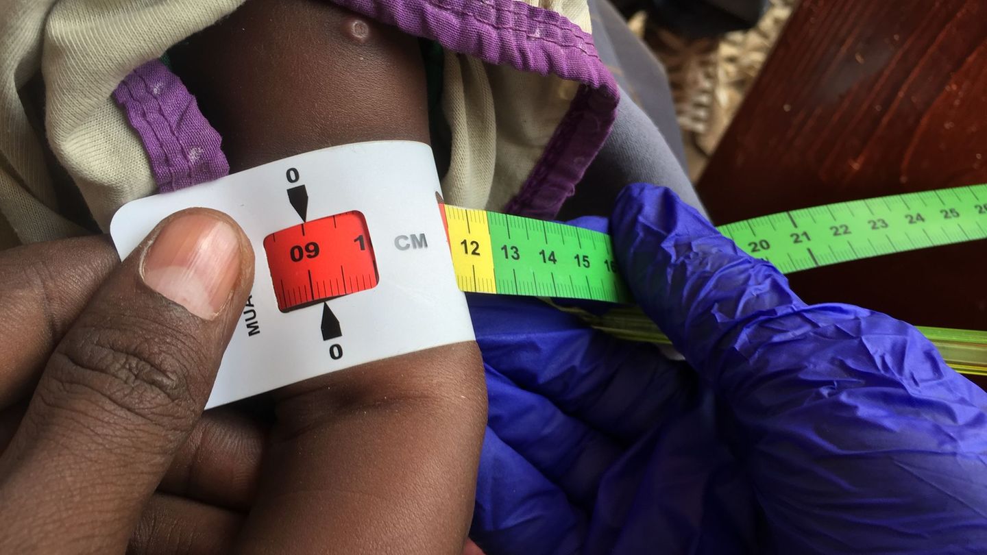 Fight against hunger: progress against hunger – but not everywhere