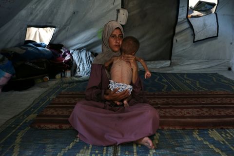Die 31-jährige Hidaya mit ihrem von Mangelernährung betroffenen Kind im Gazastreifen