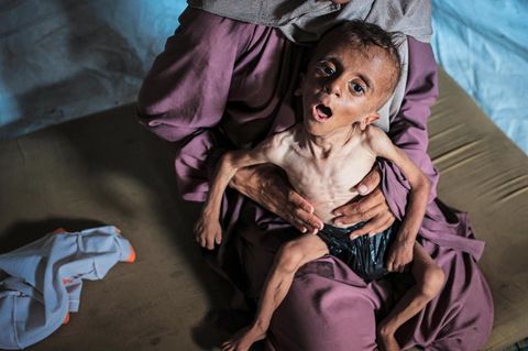 Muhammad ist 18 Monate alt, nur noch Haut und Knochen, sechs Kilogramm leicht. Statt einer Windel trägt er eine Plastiktüte. Die Physiotherapie, die der Kleine gegen seine Entwicklungsstörung erhielt, kann nicht mehr stattfinden. Mutter Hedaya, 31, hat keine Babynahrung, lebt mit ihrem schwer unterernährten Sohn in einem Zelt in Gaza-Stadt, das Fotograf Ahmed al-Arini an ein Grab erinnerte. Muhammad ist nur eines von Tausenden palästinensischen Kindern, die dieses Schicksal teilen – ein Gesicht dieses Krieges, dessen Ende er vielleicht nicht mehr miterleben wird