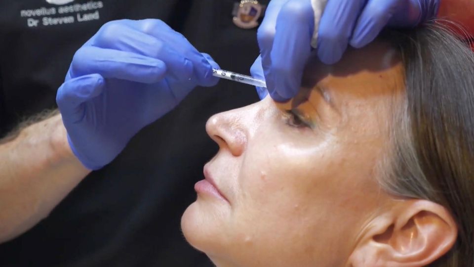 Frau wird Botox gespritzt Eine Frau lässt sich in die Stirn Botox spritzen.