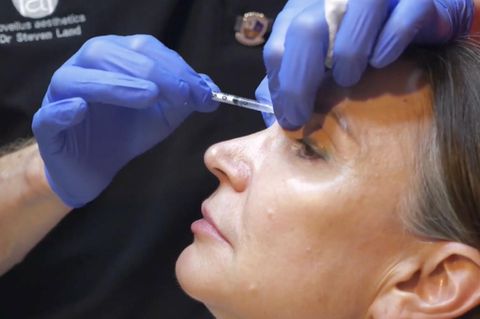 Eine Frau lässt sich in die Stirn Botox spritzen.
