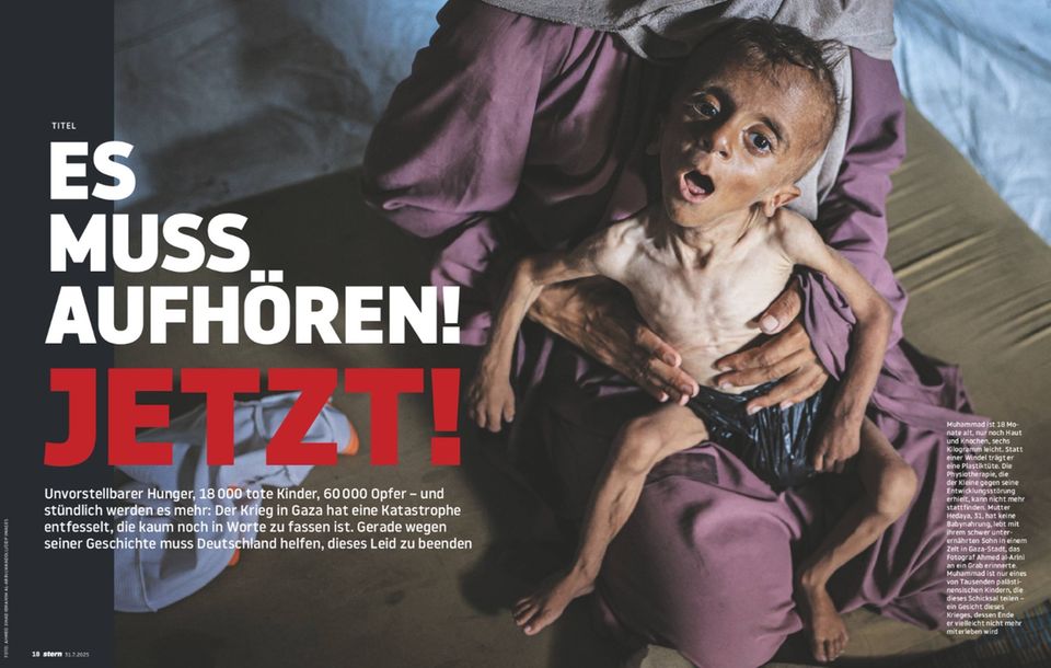 Child gaza developmental disorder