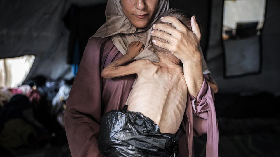 Mutter mit unterernährtem Kind in Gaza