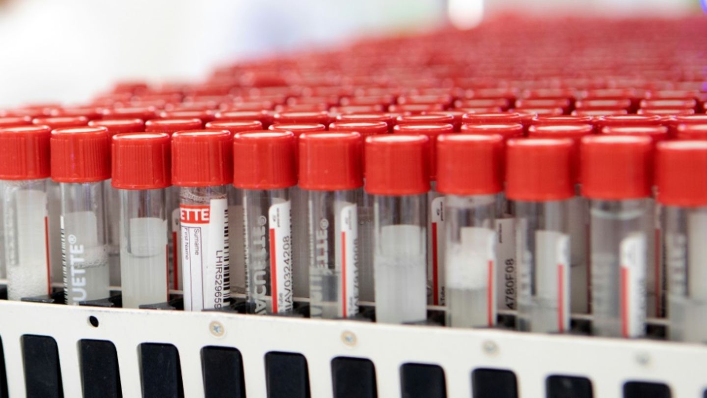 Proben für Testungen auf das Coronavirus