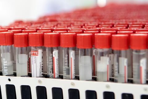 Proben für Testungen auf das Coronavirus