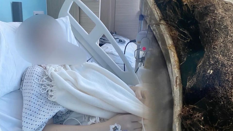 Die 14-jährige Engländerin im Krankenhausbett, daneben ein Bild von einr großen Schale voller Haare.