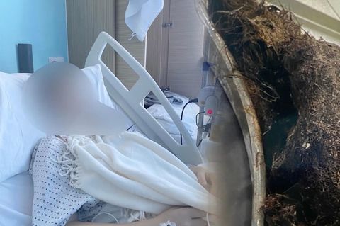 Die 14-jährige Engländerin im Krankenhausbett, daneben ein Bild von einr großen Schale voller Haare.
