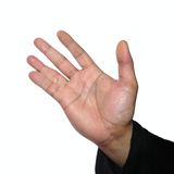 Körpermerkmale: Hand mit zusammengewachsenen Fingern