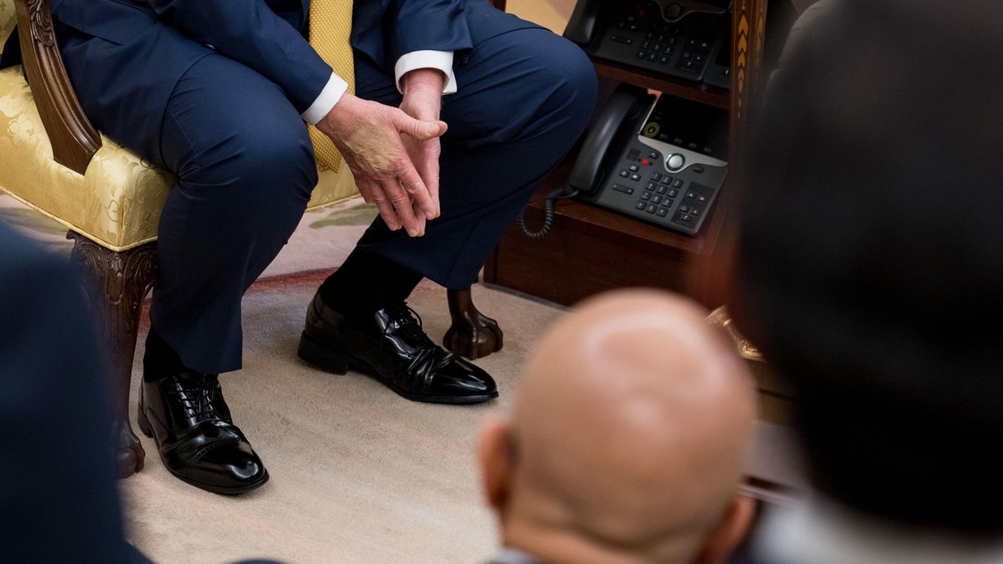 Donald Trump: Dicke Beine und wirre Auftritte