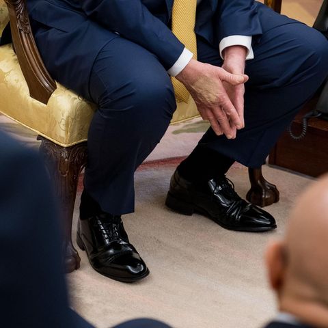 Donald Trump: Dicke Beine und wirre Auftritte