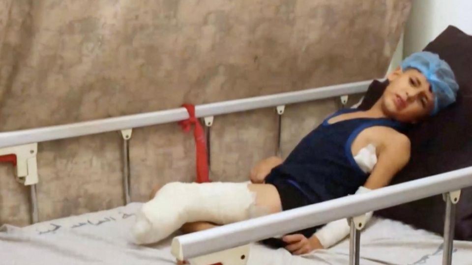 Amputation Junge Gaza Ein Junge liegt mit amputiertem linken Fuß auf einer Trage.