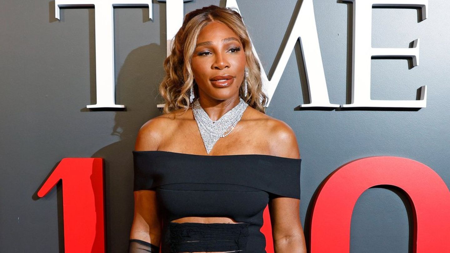 Tennis star Serena Williams before 14 kilos by weight loss injection