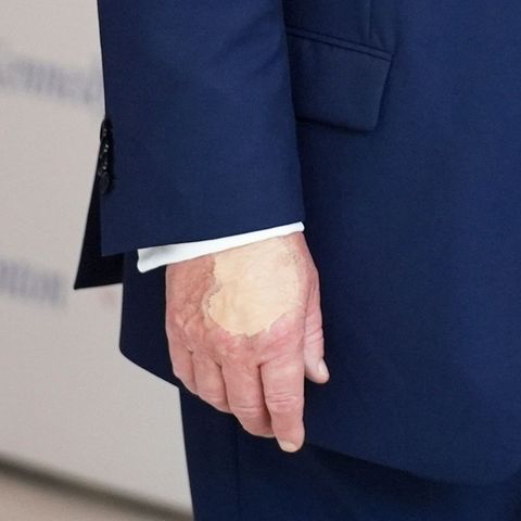 Schminkflecken an Donald Trumps Hand