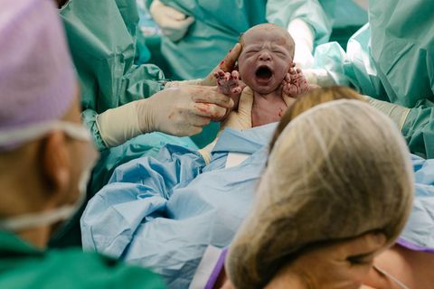 Der Moment der Geburt: Beim mütterlich assistierten Kaiserschnitt greift die Mutter ihrem Baby unter die Arme und hebt es aus dem Bauch auf ihre Brust. Die Bilder zeigen nicht Ann-Kathrin und Marc, sondern ein anderes Paar, das in der Heidelberger Klinik St. Elisabeth sein Kind zur Welt brachte