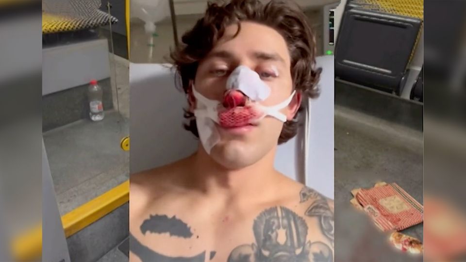 Ein junger Mann schaut in die Kamera, Blut läuft ihm über sein unteres Gesicht.