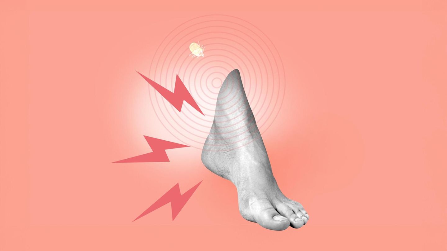 Illustration eines schmerzenden Fußes