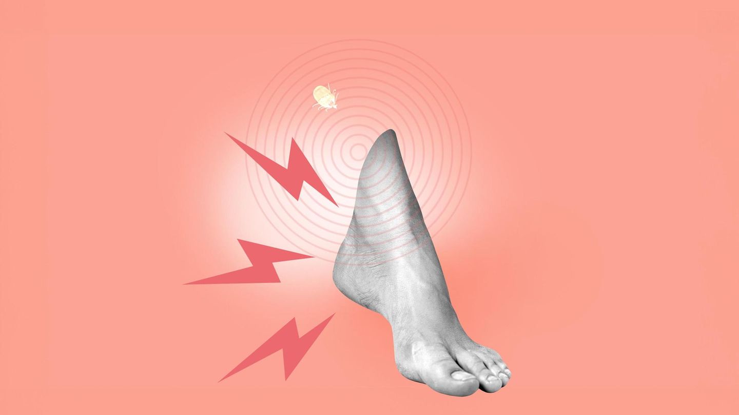 Stechen im Fuß Illustration eines schmerzenden Fußes