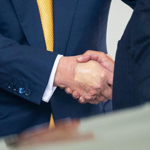 Dezente Herrenschminke: Wiederholt zeigte sich Donald Trump mit Blessuren an den Händen. Mal sind sie abgedeckt, mal nicht. Und jedes Mal ein Gegenstand öffentlicher Erregung