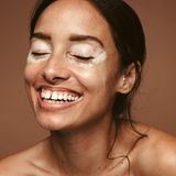 Haut: Frau mit weißen Flecken im Gesicht – Vitiligo