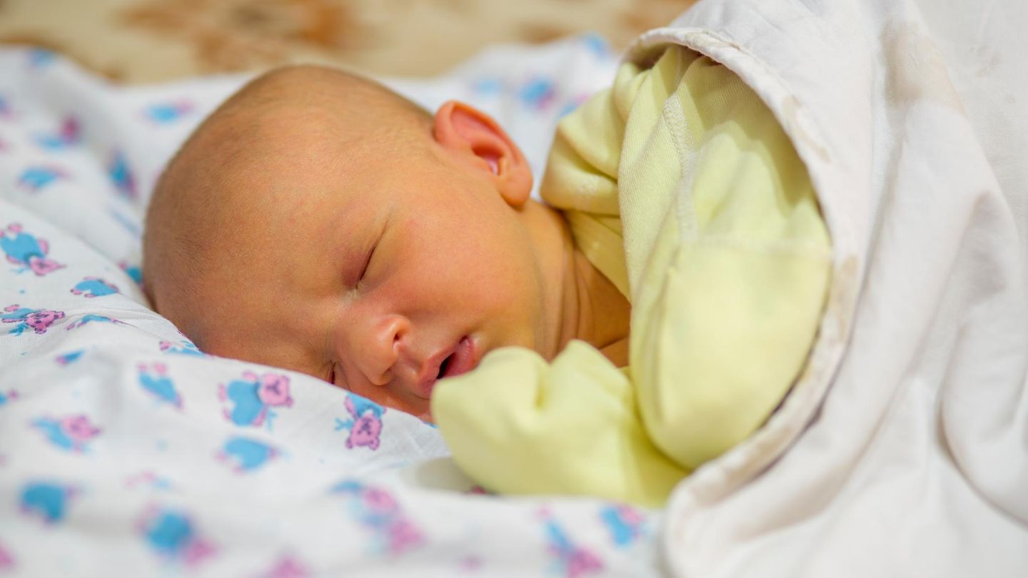 Haut: Baby mit gleblicher Haut, einem Neugeborenen-Ikterus Haut: Baby mit gleblicher Haut, einem Neugeborenen-Ikterus