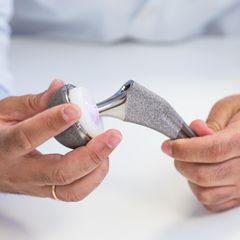 Hüftchirurgie: Arzt zeigt eine Hüftprothese