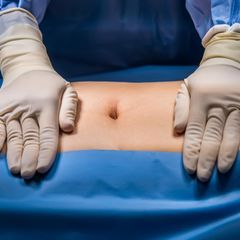 Hernien: Ein Arzt bereitet eine Hernienoperation vor