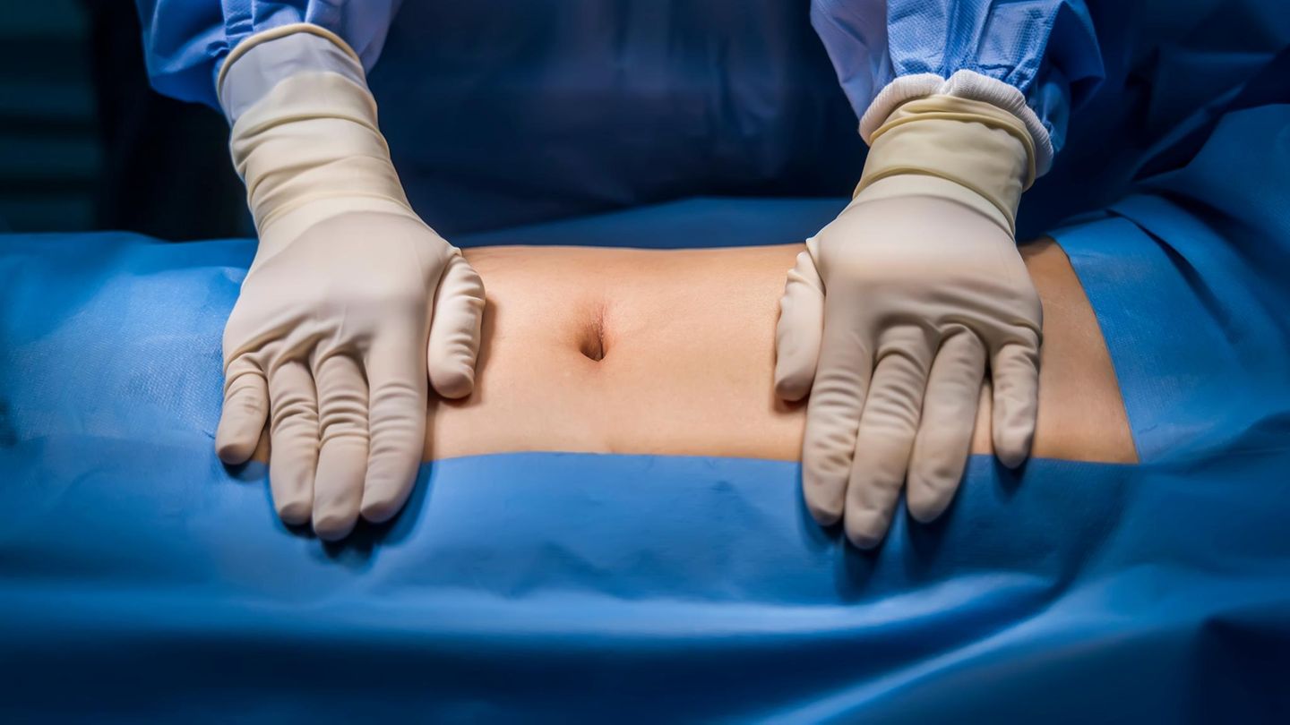 Hernien: Ein Arzt bereitet eine Hernienoperation vor