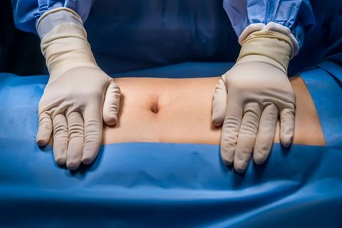 Hernien: Ein Arzt bereitet eine Hernienoperation vor