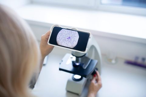 Hämatologie und Onkologie: Arzt untersucht das Blut eines Patienten