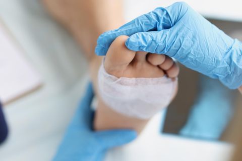 Fußchirurgie: Arzt untersucht Fuß eines Patienten