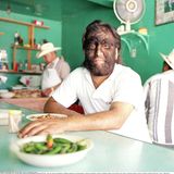 Haut: Mann mit Hypertrchose