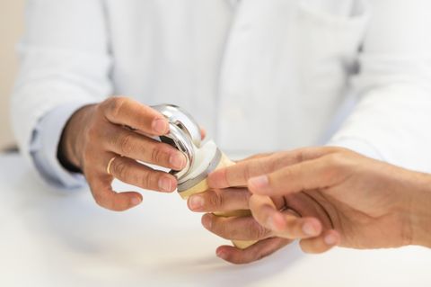 Knieendoprothetik:  Arzt hält ein Knieprothese in die Kamera