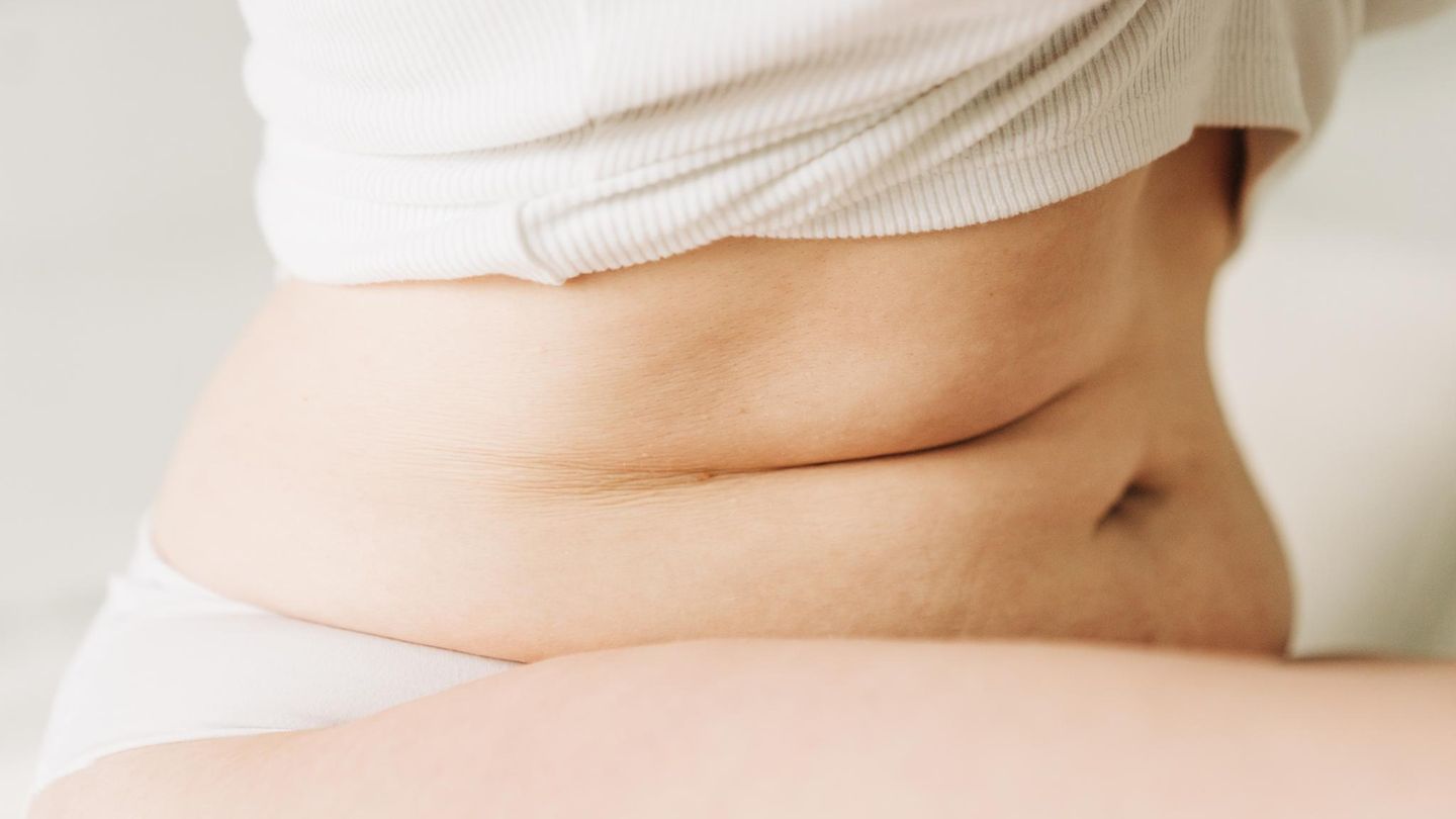 Lipidologie: Bauch einer Frau