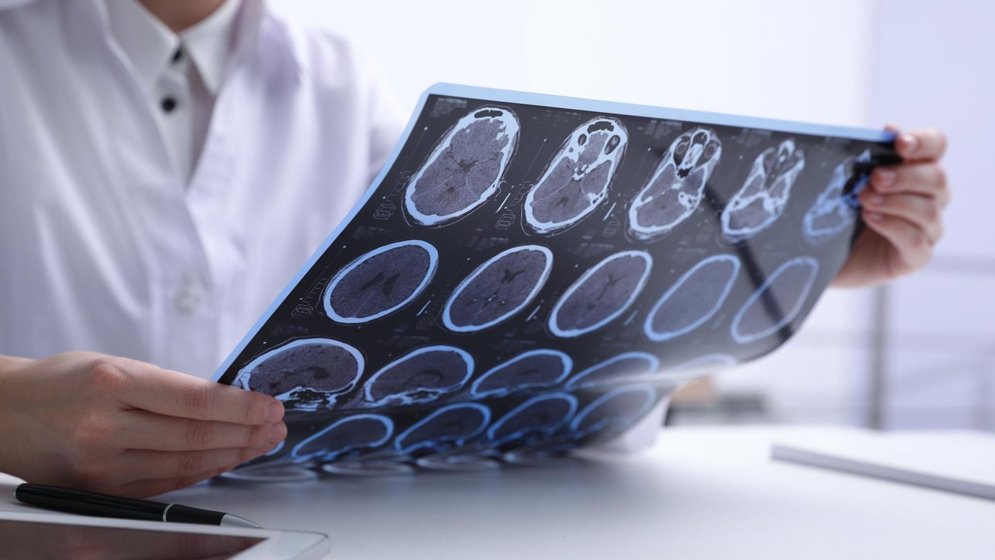 Neurologie: Arzt hält eine Röntgenaufnahme in den Händen, zeigt das Gehirn eines Patienten