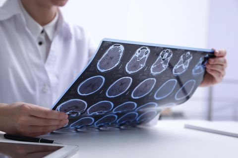 Neurologie: Arzt hält eine Röntgenaufnahme in den Händen, zeigt das Gehirn eines Patienten