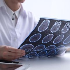 Neurologie: Arzt hält eine Röntgenaufnahme in den Händen, zeigt das Gehirn eines Patienten