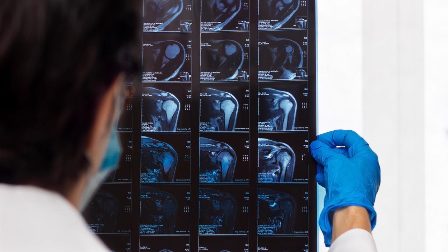 Schulterchirurgie: Arzt hält Röntgenaufnahme einer Schulter
