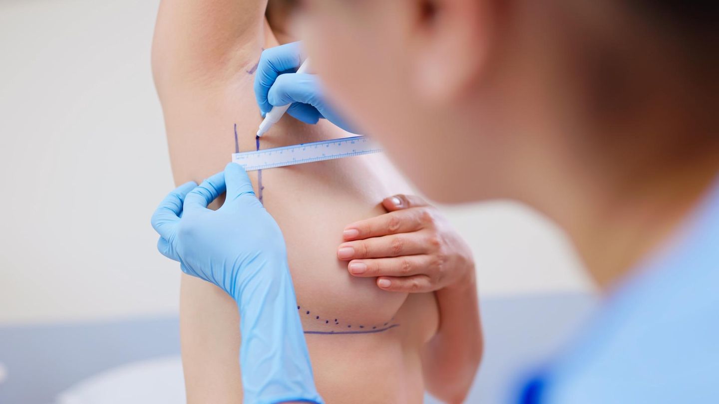 Ästhetische Brustchirurgie: Ärztin bereitet eine Patientin für die Brustchirurgie vor