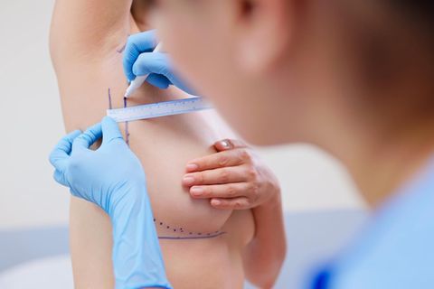 Ästhetische Brustchirurgie: Ärztin bereitet eine Patientin für die Brustchirurgie vor