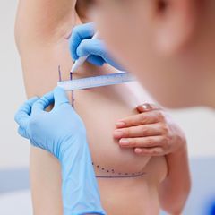 Ästhetische Brustchirurgie: Ärztin bereitet eine Patientin für die Brustchirurgie vor